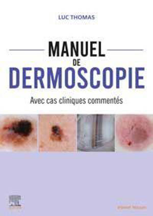 Manuel de dermoscopie : avec cas cliniques commentés - Luc Thomas