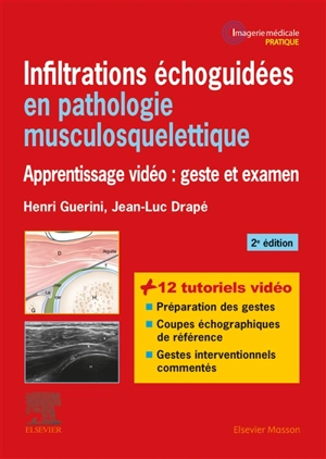 Infiltrations échoguidées en pathologie musculosquelettique : apprentissage vidéo : geste et examen - Jean-Luc Drapé