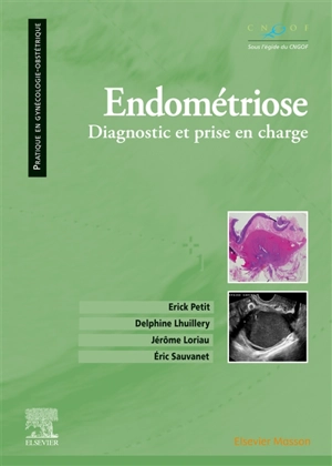 Endométriose : diagnostic et prise en charge