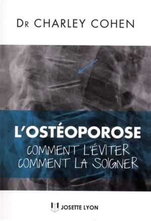 L'ostéoporose : comment l'éviter, comment la soigner - Charley Cohen