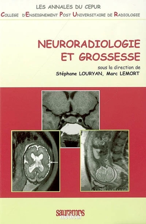 Neuroradiologie et grossesse