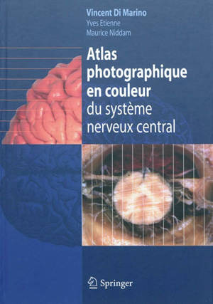 Atlas photographique en couleur du système nerveux central - Vincent Di Marino