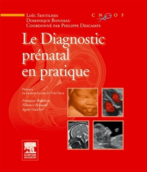 Le diagnostic prénatal en pratique - Loïc Sentilhes
