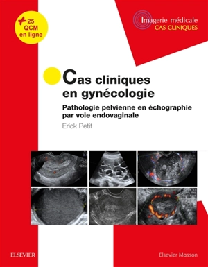 Cas cliniques en gynécologie : pathologie pelvienne en échographie par voie endovaginale - Erick Petit