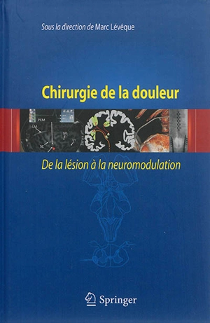 Chirurgie de la douleur : de la lésion à la neuromodulation