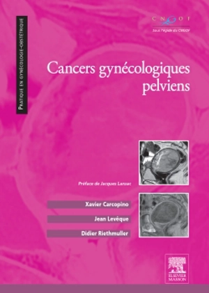 Cancers gynécologiques pelviens - Xavier Carcopino