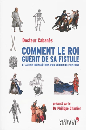 Comment le roi guérit de sa fistule : et autres indiscrétions d'un médecin de l'histoire - Augustin Cabanès