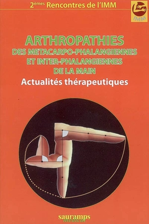 Arthropathies des métacarpo-phalangiennes et inter-phalangiennes de la main : actualités thérapeutiques - Institut montpelliérain de la main et du membre supérieur. Rencontres (2 ; 2008 ; Palavas-les-Flots, Hérault)