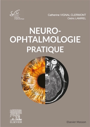 Neuro-ophtalmologie pratique : rapport 2020 - Société française d'ophtalmologie