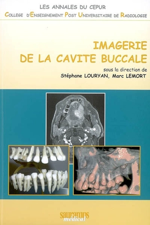 Imagerie de la cavité buccale