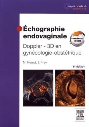 Echographie endovaginale : Doppler 3D en gynécologie-obstétrique - Nicolas Perrot