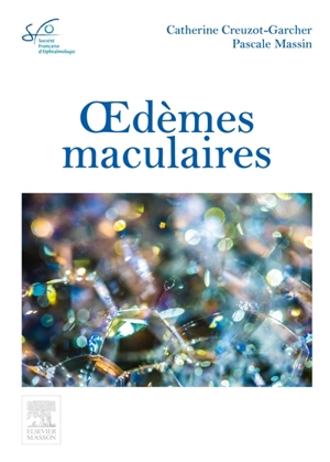 Oedèmes maculaires : rapport SFO 2016 - Société française d'ophtalmologie