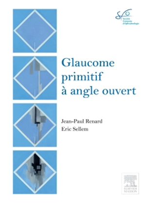 Glaucome primitif à angle ouvert - Société française d'ophtalmologie