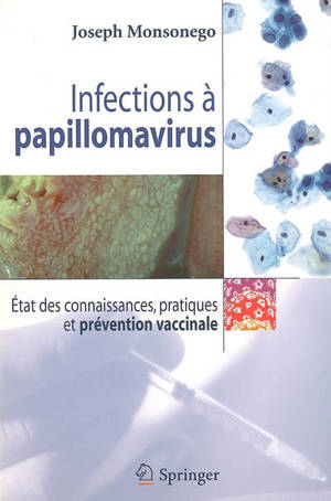 Infections à papillomavirus : états des connaissances, pratiques et prévention vaccinale - Joseph Monsonego