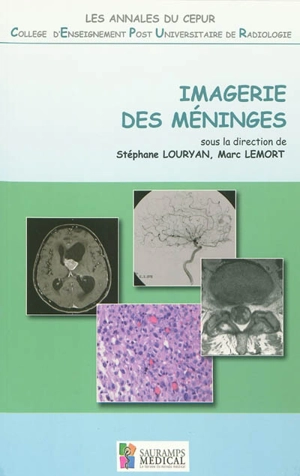 Imagerie des méninges