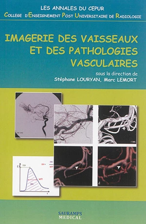 Imagerie des vaisseaux et des pathologies vasculaires