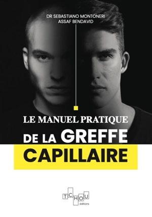 Le manuel pratique de la greffe capillaire - Sébastiano Montoneri