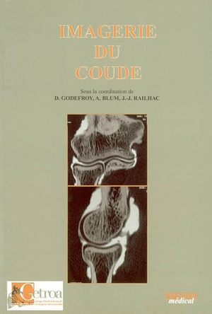 Imagerie du coude