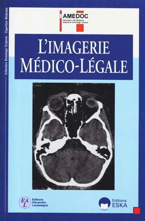 L'imagerie médico-légale - Association des médecins experts en dommage corporel (France)