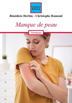 Manque de peau - Bénédicte Herbin