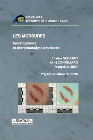 Les morsures : investigations et morphoanalyse des traces - Charles Georget