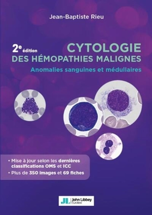 Cytologie des hémopathies malignes : anomalies sanguines et médullaires - Jean-Baptiste Rieu