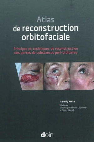 Atlas de reconstruction orbitofaciale : principes et techniques de reconstruction des pertes de substances péri-orbitaires - Gerald J. Harris