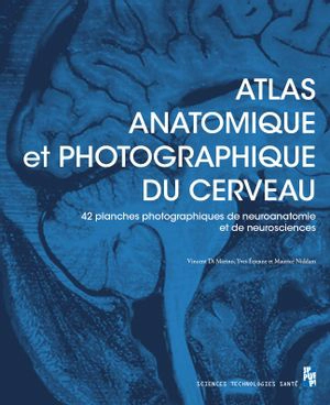 Atlas anatomique et photographique du cerveau : 42 planches (dont 41 photographiques) pour les passionnés de neuroanatomie et de neurosciences - Vincent Di Marino