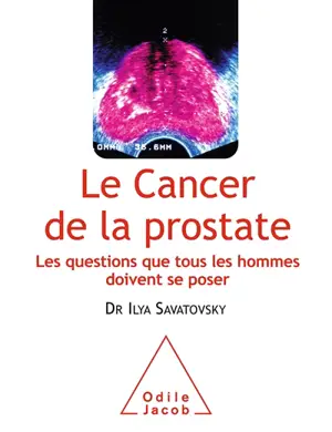 Le cancer de la prostate : les questions que tous les hommes doivent se poser - Ilya Savatovsky