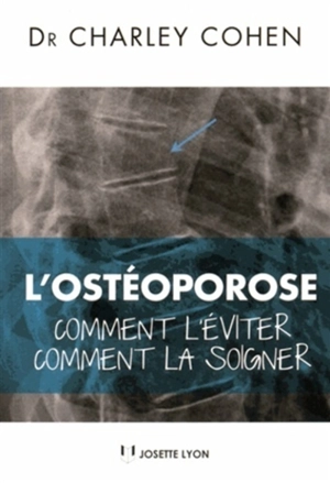 L'ostéoporose : comment l'éviter, comment la soigner - Charley Cohen