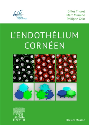 Lendothélium cornéen - Société française d'ophtalmologie